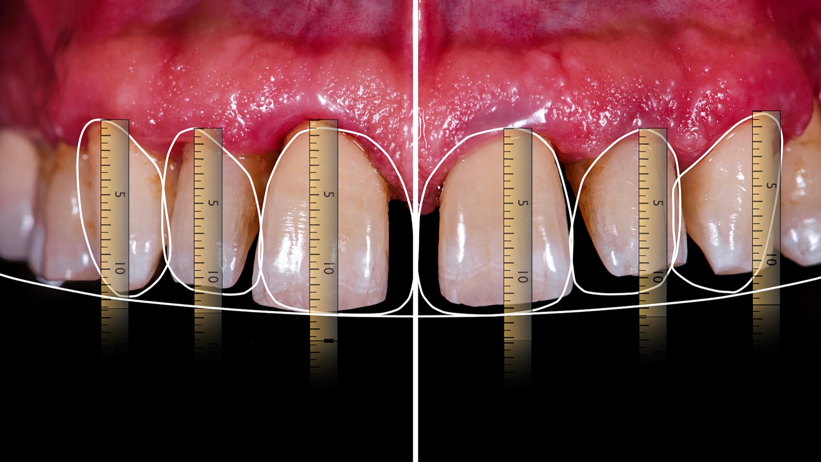 Digital Smile Design: Skills You Need to Start Aesthetic Cases