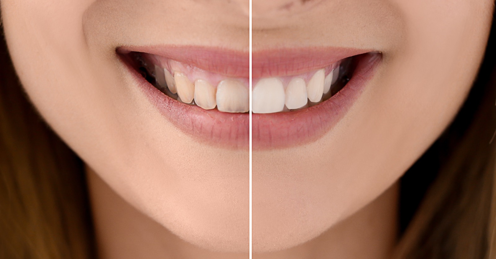 Aesthetic Dentistry