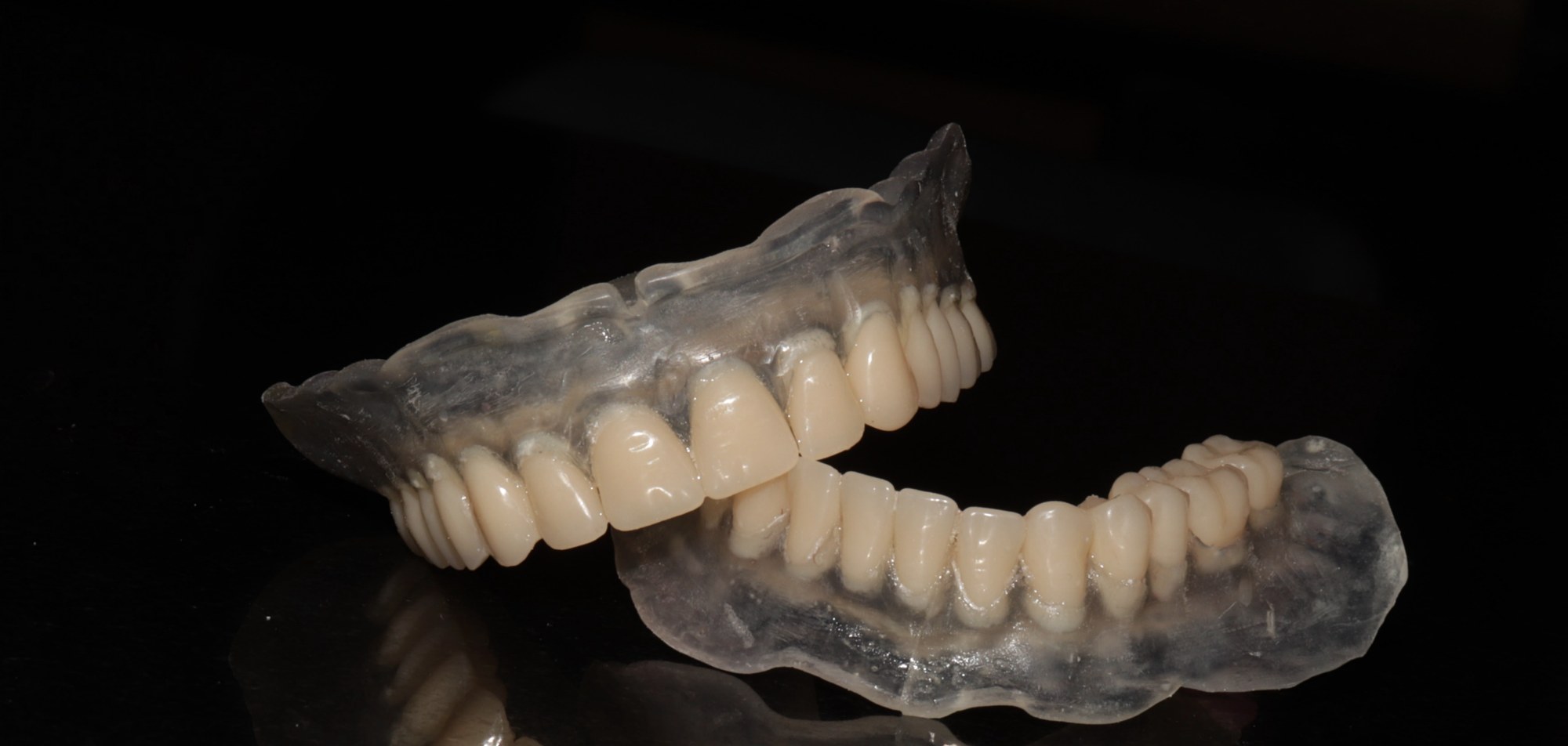 Digitally designed and milled complete dentures showing precise occlusion