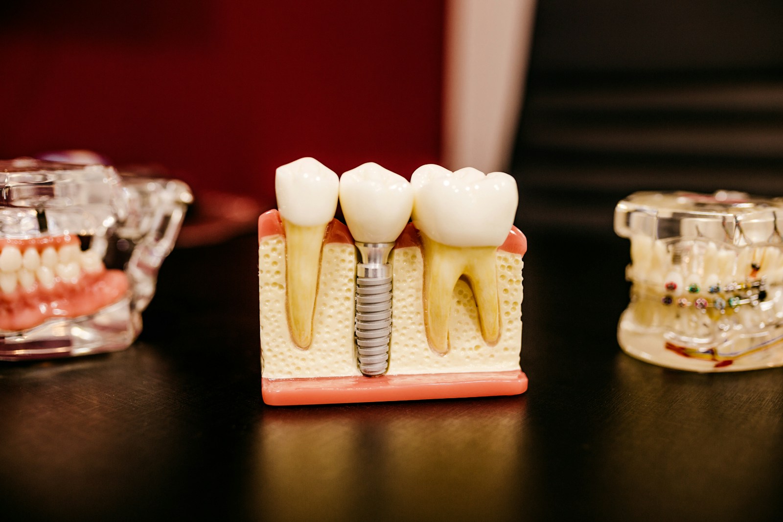Digital Prosthodontics