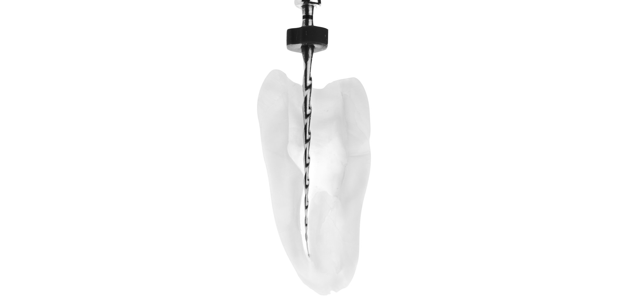 Endodontic access preparation with a rotary handpiece and bur on a tooth model